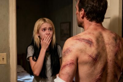 She Saw Her Dad’s Back for the First Time… and Her Whole World Changed…