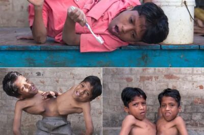 In the dusty lanes of Raipur, two brothers fused as one—Shivnath and Shivram—defy every limit with four arms and two legs pounding in perfect sync. Born conjoined, they refused the knife of separation…